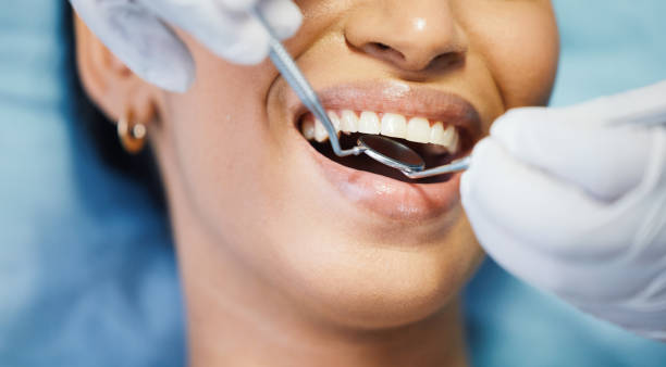 Best Emergency Gum Treatment in Escobares, TX