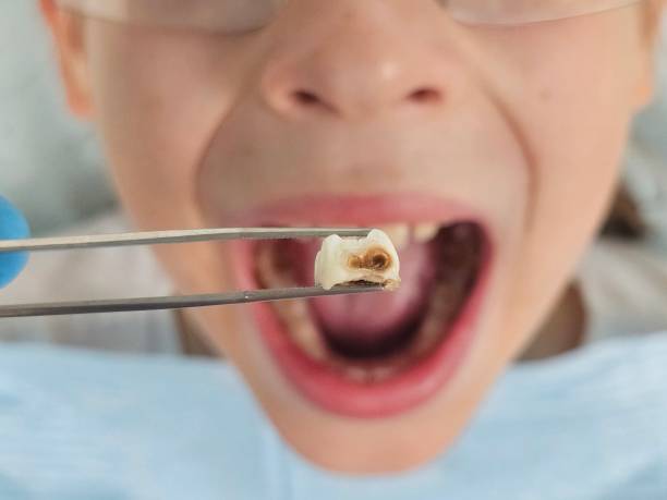 Best Urgent Care for Lost Fillings or Crowns in Escobares, TX